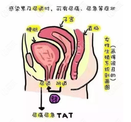 最新缩阴手术技术进展，女性健康的新选择探索